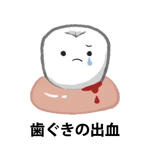 歯ぐきの出血