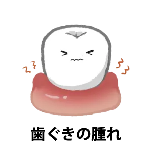 歯ぐきの腫れ