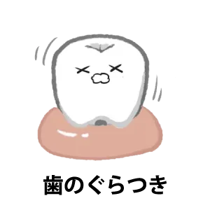 歯のぐらつき
